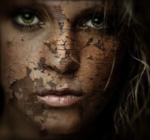 seborroïsch eczeem gezichtscreme