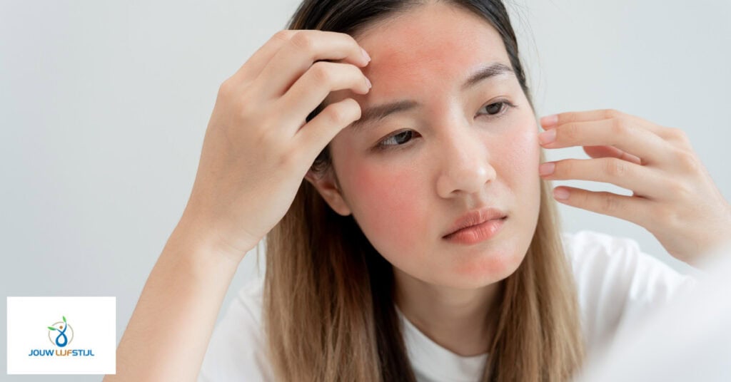 Effectieve Behandelingen Voor Allergische Reactie Gezichtscrème